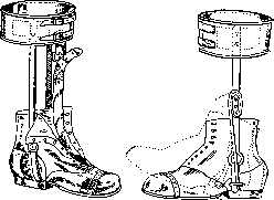 Orthopedic Appliances: figure 24 from the 1928–1936 encyclopedia article