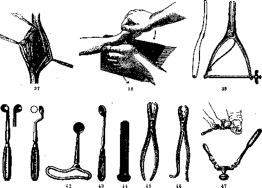 Orthopedic Appliances: figure 28 from the 1928–1936 encyclopedia article