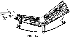 Orthopedic Appliances: figure 13 from the 1928–1936 encyclopedia article