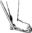 Orthopedic Appliances: figure 21 from the 1928–1936 encyclopedia article