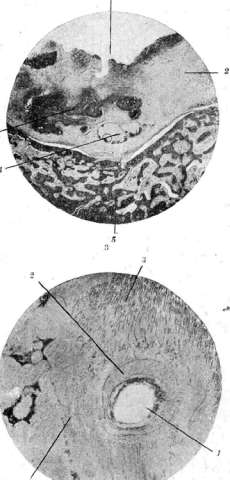 Odontoma: figure 1 from the 1928–1936 encyclopedia article