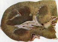 Kidneys: figure 23 from the 1928–1936 encyclopedia article
