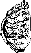 Tonsil Pharyngeal: figure 1 from the 1928–1936 encyclopedia article