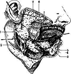 Parotid Gland: figure 3 from the 1928–1936 encyclopedia article