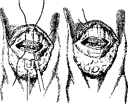 Patella: figure 3 from the 1928–1936 encyclopedia article