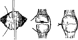 Patella: figure 4 from the 1928–1936 encyclopedia article