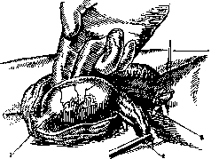 Castration: figure 2 from the 1928–1936 encyclopedia article