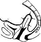 Uterine Prolapse: figure 8 from the 1928–1936 encyclopedia article