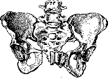 Pelveoperitonitis: figure 15 from the 1928–1936 encyclopedia article