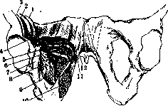 Pelveoperitonitis: figure 7 from the 1928–1936 encyclopedia article
