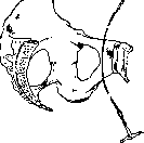 Pelveoperitonitis: figure 14 from the 1928–1936 encyclopedia article