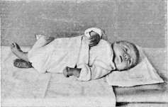 Infant: figure 7 from the 1928–1936 encyclopedia article