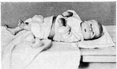 Infant: figure 6 from the 1928–1936 encyclopedia article