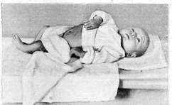 Infant: figure 5 from the 1928–1936 encyclopedia article