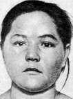 Goiter: figure 5 from the 1928–1936 encyclopedia article