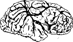 Porencephaly: figure 1 from the 1928–1936 encyclopedia article