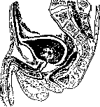 Rectal Prolapse: figure 1 from the 1928–1936 encyclopedia article