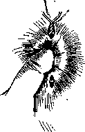 Rectal Prolapse: figure 7 from the 1928–1936 encyclopedia article