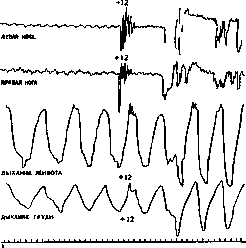 Expressive Movements: figure 2 from the 1928–1936 encyclopedia article