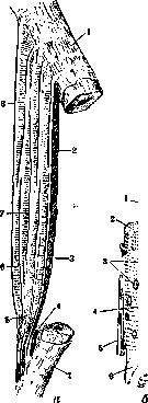 Kyphosis (or roundback, see): figure 3 from the 1928–1936 encyclopedia article
