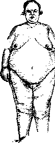 Obesity: figure 2 from the 1928–1936 encyclopedia article
