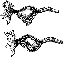 Pregnancy: figure 16 from the 1928–1936 encyclopedia article