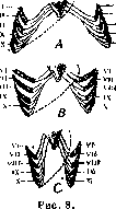 Splanchnoptosis: figure 6 from the 1928–1936 encyclopedia article