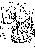 Splanchnoptosis: figure 4 from the 1928–1936 encyclopedia article