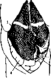 Splanchnoptosis: figure 7 from the 1928–1936 encyclopedia article