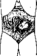Splanchnoptosis: figure 3 from the 1928–1936 encyclopedia article
