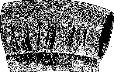 Intestine: figure 14 from the 1928–1936 encyclopedia article