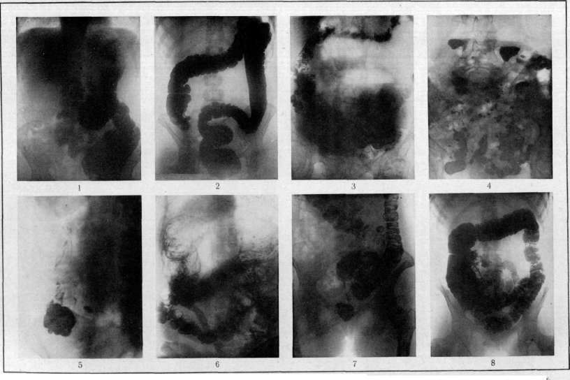 Intestine: figure 21 from the 1928–1936 encyclopedia article