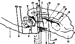 Decerebration (DECEREBRATE): figure 2 from the 1928–1936 encyclopedia article