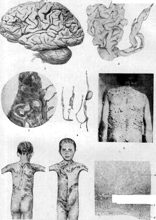 Adrenal Glands: figure 16 from the 1928–1936 encyclopedia article