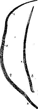 Trichinellosis: figure 1 from the 1928–1936 encyclopedia article