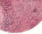 Feces: figure 5 from the 1928–1936 encyclopedia article