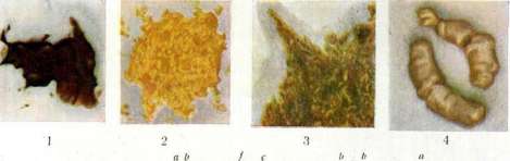 Feces: figure 1 from the 1928–1936 encyclopedia article