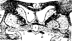Commissural Fibers: figure 2 from the 1928–1936 encyclopedia article