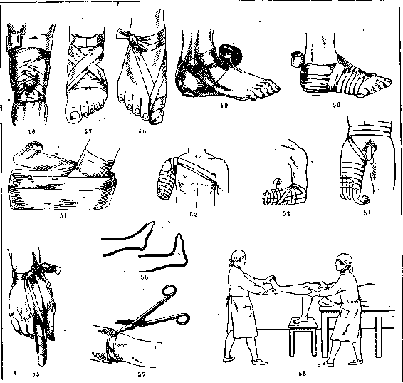 Injuries: figure 3 from the 1928–1936 encyclopedia article
