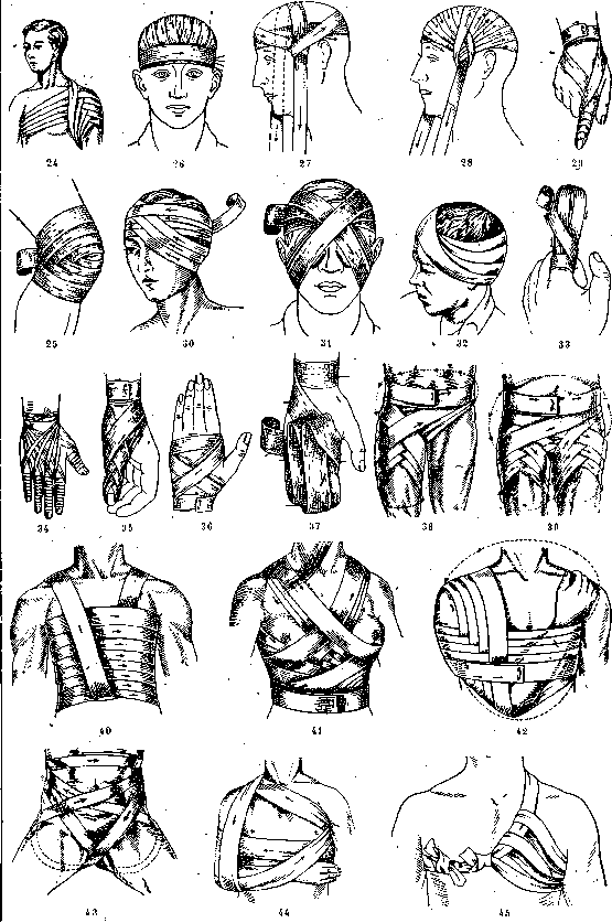 Injuries: figure 2 from the 1928–1936 encyclopedia article