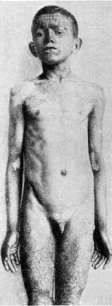 Immunotherapy: figure 4 from the 1928–1936 encyclopedia article