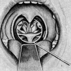 Pharynx: figure 3 from the 1928–1936 encyclopedia article