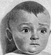 Wolff: figure 2 from the 1928–1936 encyclopedia article