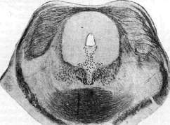 Trichophytosis: figure 2 from the 1928–1936 encyclopedia article