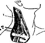 Local Anesthesia: figure 2 from the 1928–1936 encyclopedia article