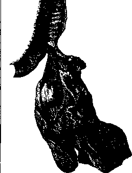 Bronchi: figure 15 from the 1928–1936 encyclopedia article