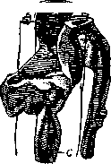 Bronchi: figure 4 from the 1928–1936 encyclopedia article