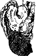 Bronchi: figure 17 from the 1928–1936 encyclopedia article