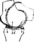 Articular Menisci: figure 7 from the 1928–1936 encyclopedia article