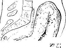 Postpartum Period: figure 1 from the 1928–1936 encyclopedia article